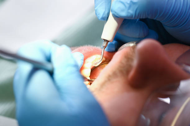 Best Emergency Dental Services for Seniors in Squaw Valley, CA