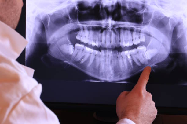 Best Emergency Dental Services for Seniors in Squaw Valley, CA