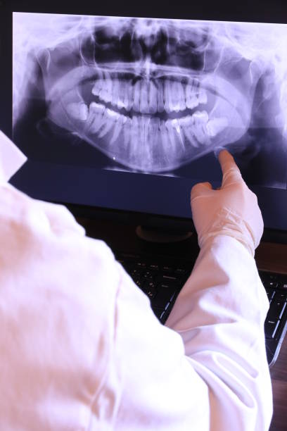 Best Emergency Dentist for Lost Fillings or Crowns in Squaw Valley, CA